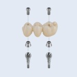 AG_Equipment_Ceramill_Ti-Connect_SR_bridge